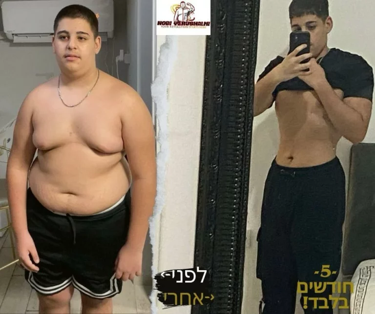 לפני אחרי