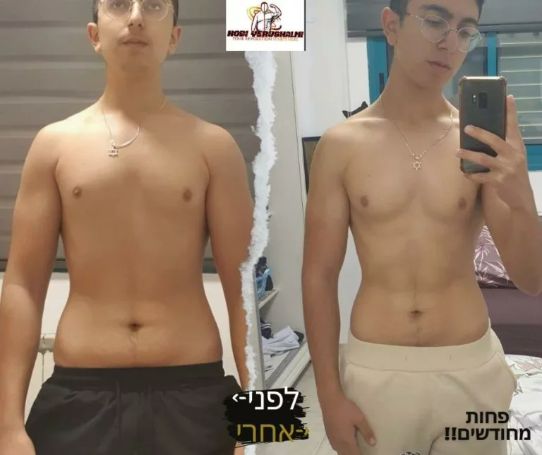 לפני אחרי